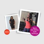 Mary lost 30 pounds with the ReShape gastric balloon and she is thrilled with her new healthy lifestyle!