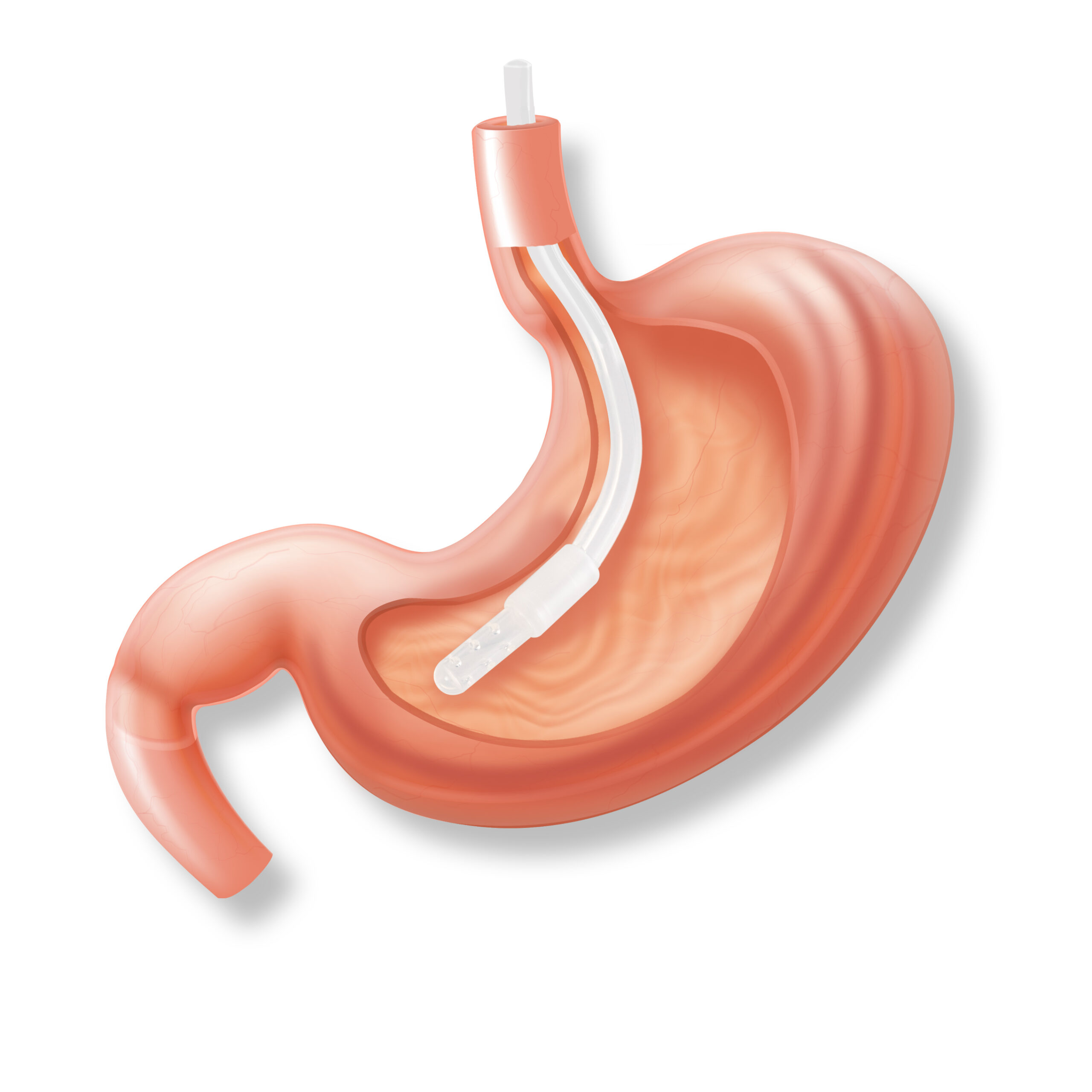 Stomach Illustration 2 R3